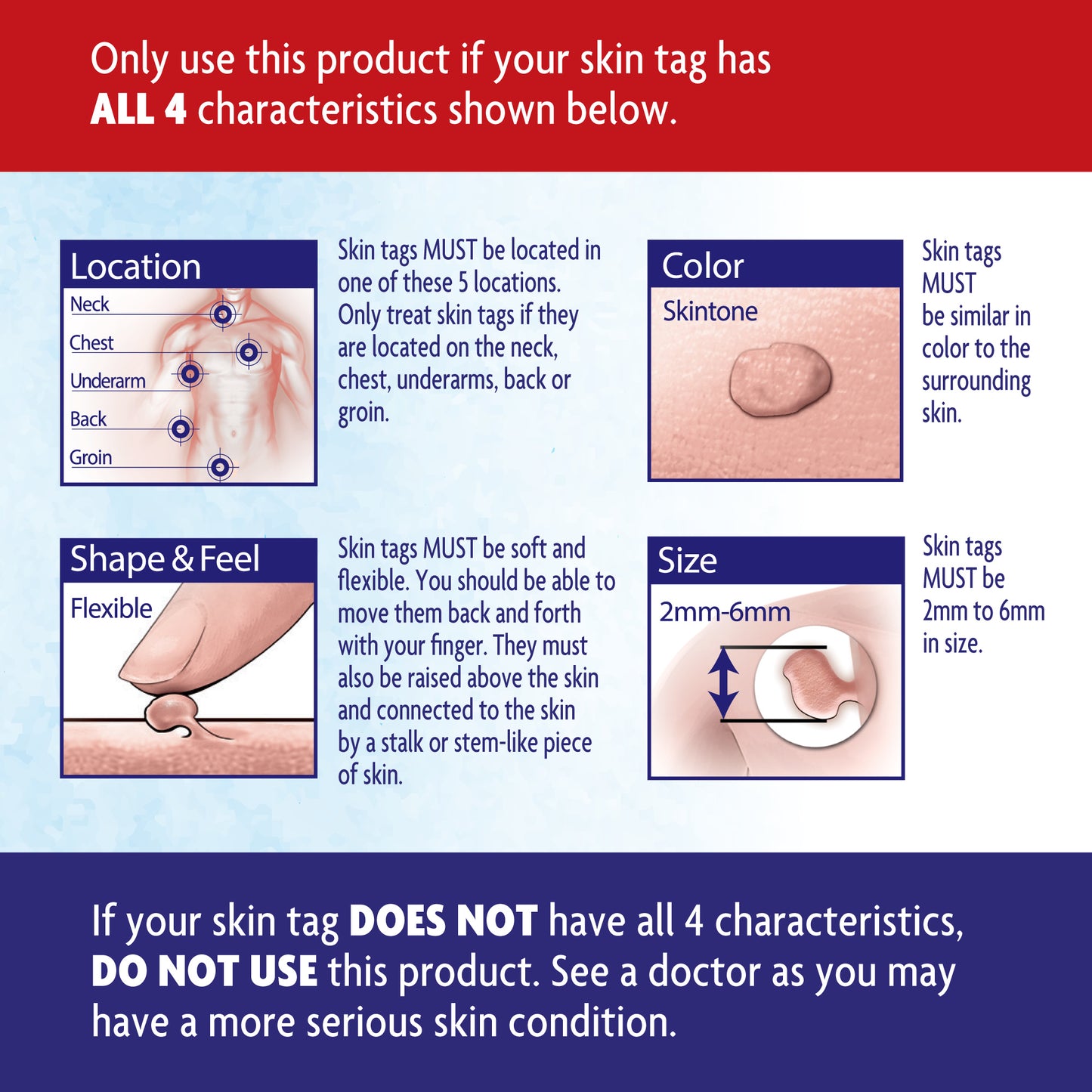 Informational image highlighting the 4 characteristics of a skin tag including location, color, shape and feel, and size with warning that skin tag much possess all 4 characteristics in order to be effective with Alocane Precision Freeze